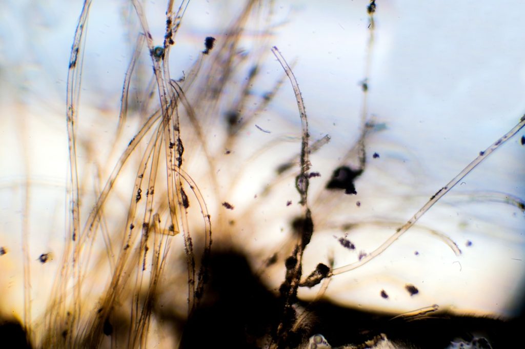 蘑菇生命周期的详细解释 6 hyphae 1
